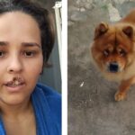 😱 Mulher tem Rosto DESTRUÍDO por Cachorro e a Cirurgia INOVADORA Vai Te Chocar!
