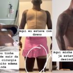 🚨 Davi Brito SURPREENDE ao exibir novo shape após Lipo HD: Veja o antes e depois! 😱