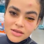 😱URGENTE: Influenciadora Quase PERDE a VISÃO por causa de MOSCA de Banheiro! Veja como se proteger!