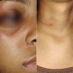 URGENTE: Ex-Funcionária do Mcdonald’s Revela Agressão e Processa Empresa!