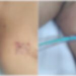 😱 Ceará em Choque: Grávida Atacada com Chave de Fenda! Ciúme Explica Brutalidade?
